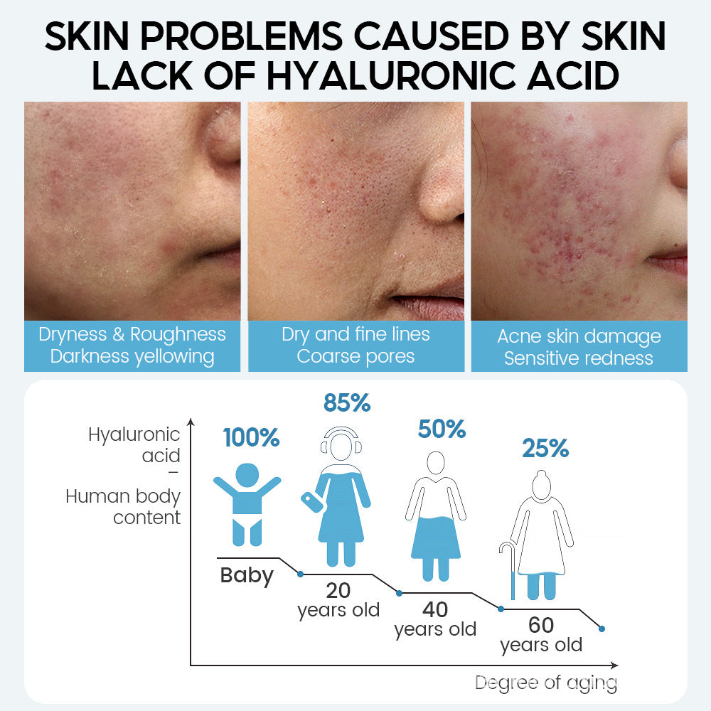 Sérum Visage Acide Hyaluronique Anti-Âge | Hyaluronic Acid Face Serum Anti-Aging